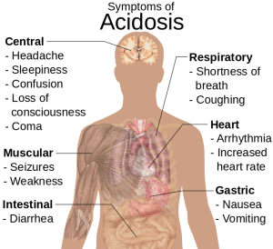 654px-Symptoms_of_acidosis_svg