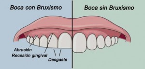 fisioterapeuta madrid 4