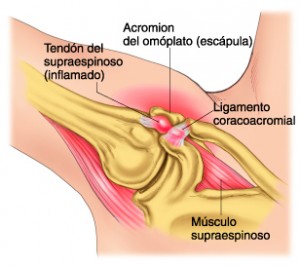 Duele la espalda la cabeza después de la operación
