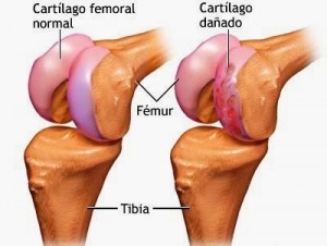 fisioterapia barrio salamanca 1
