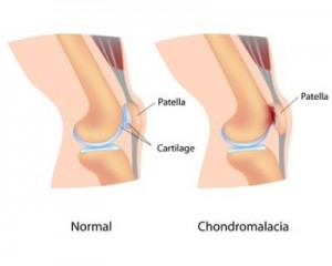 fisioterapia barrio salamanca 2