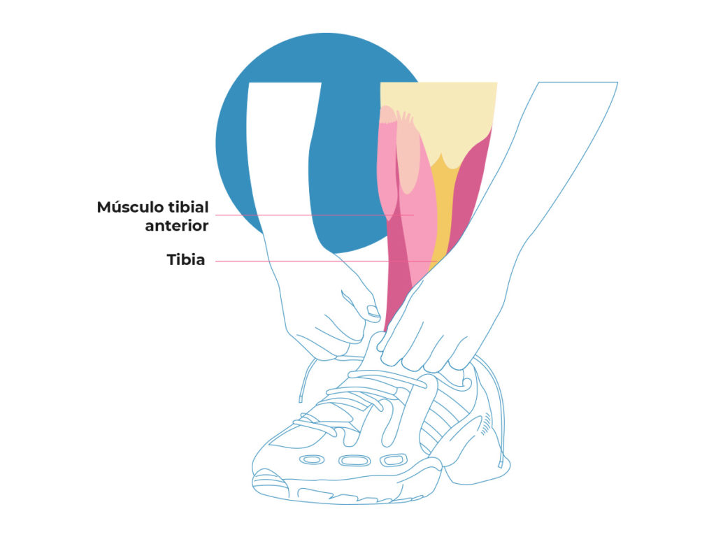 Periostitis tibial - Importancia Zapatillas