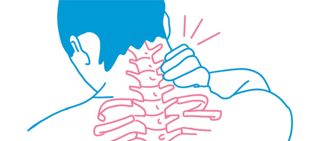 Cómo saber si tengo una hernia discal cervical