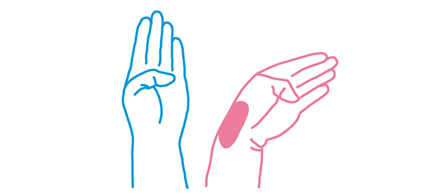 Tendinitis de Quervain - Test Finkelstein