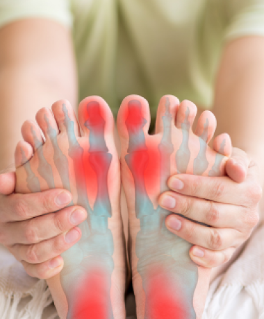 Fascitis-Plantar