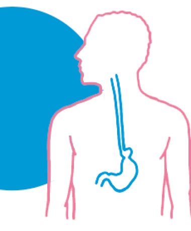 hernia-hiato-fisioterapia